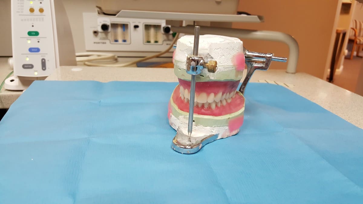 protesis-dental-removible