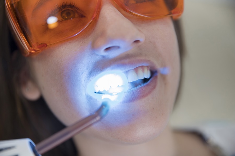 Los mejores tratamientos de estética dental