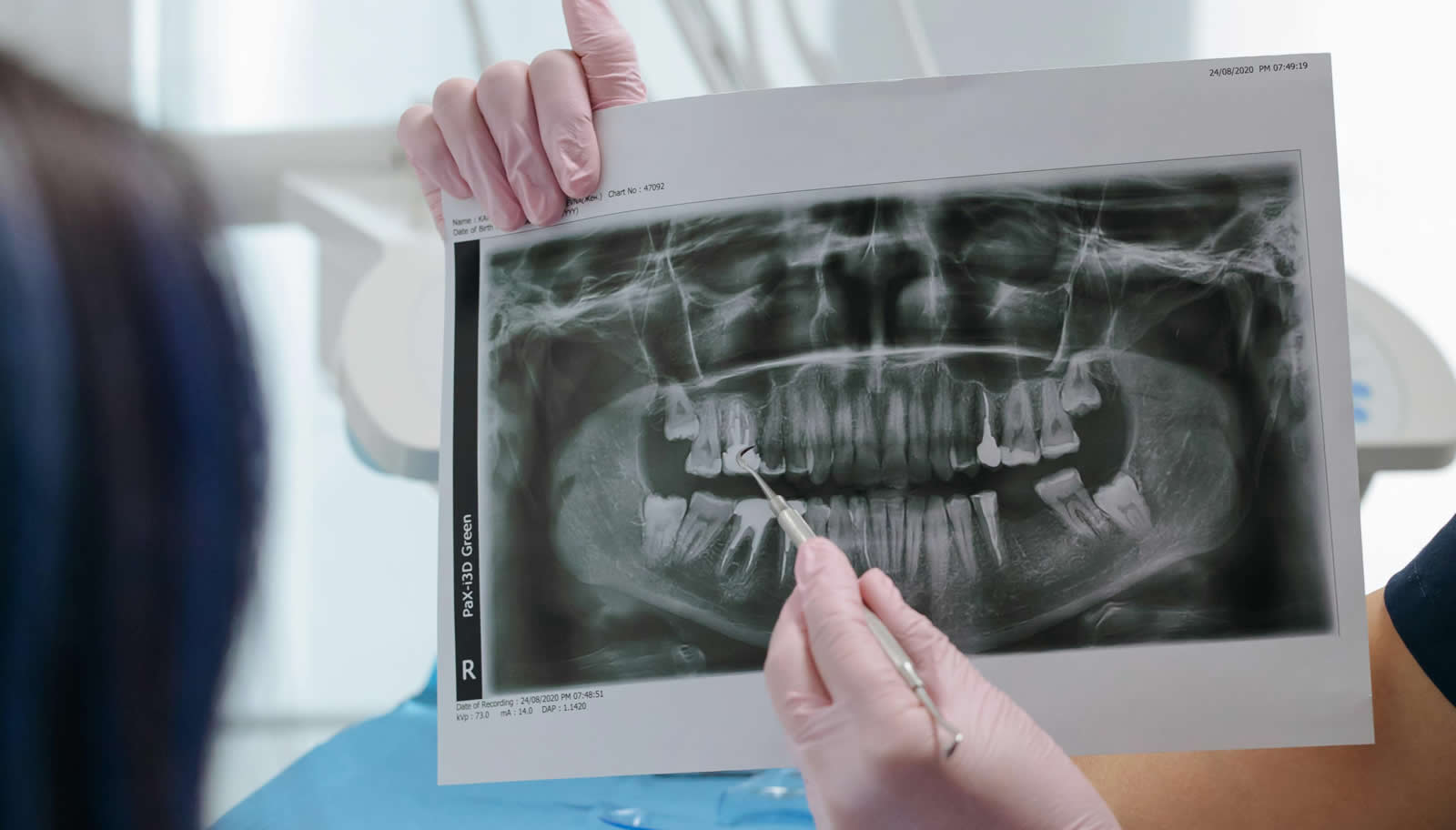 ¿Qué es la Implantología? Implantes dentales en Jerez de la Frontera